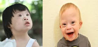 Down - Hình ảnh minh họa